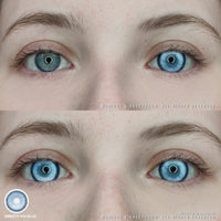 Sweety Koi Blue (1 lens/pack)-Colored Contacts-UNIQSO UK