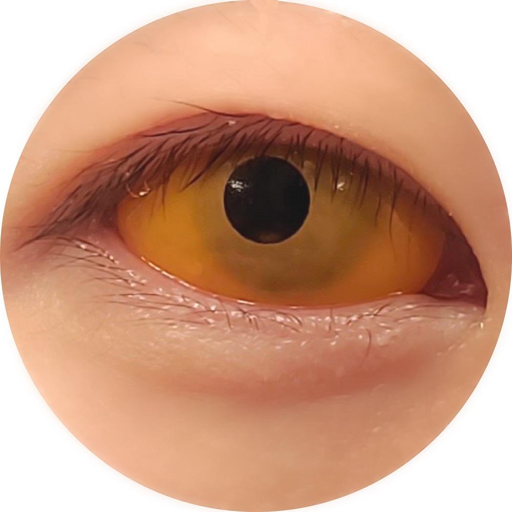 Sweety Orange Sclera Contacts (1 lens/pack)-Sclera Contacts-UNIQSO